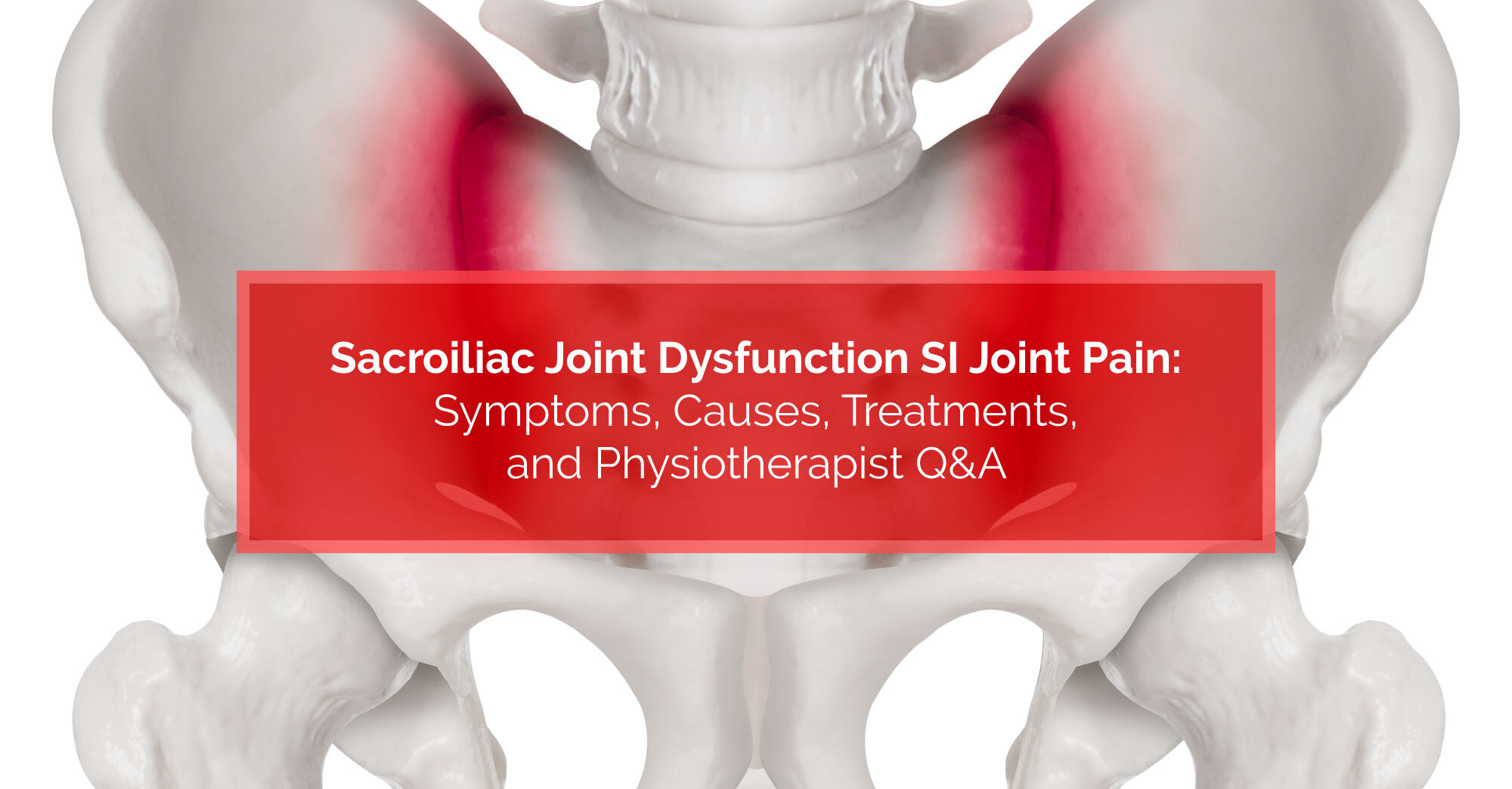Sacroiliac Joint Dysfunction Si Joint Pain Symptoms Causes